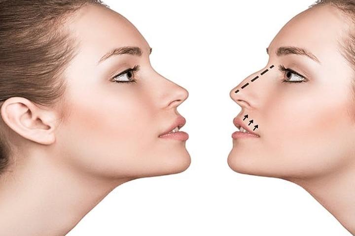 Rodzaje zabiegów chirurgii plastycznej